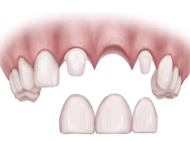 Alternative Dental Treatment Options