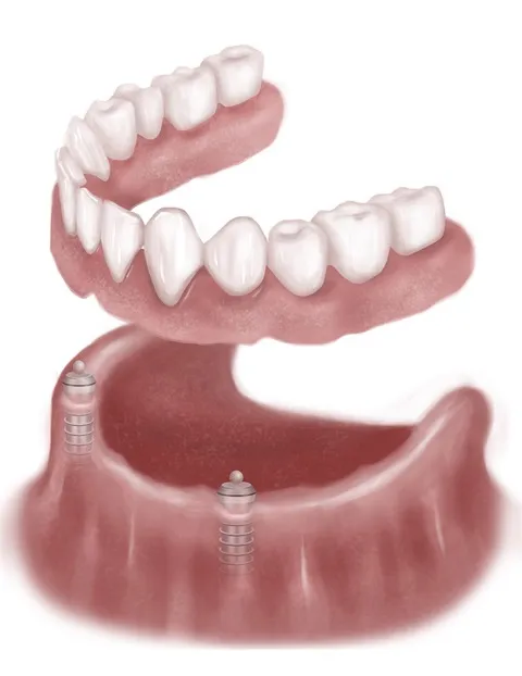 Alternative Dental Treatment Options