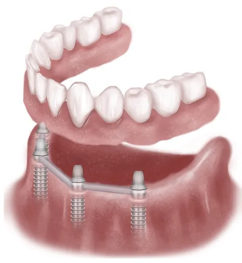 Alternative Dental Treatment Options
